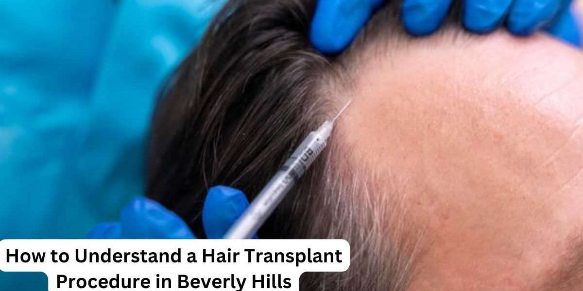 How to Understand a Hair Transplant Procedure in Beverly Hills