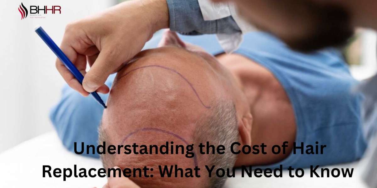 Understanding the Cost of Hair Replacement: What You Need to Know 