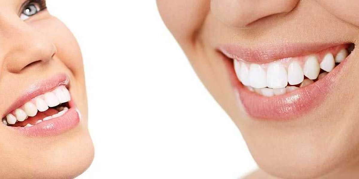 Protecting Your Newly Whitened Teeth: Maintenance Tips