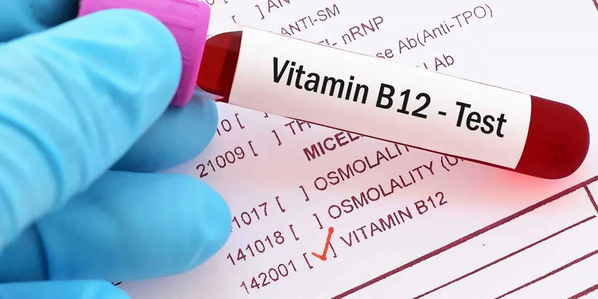 Active B12 Testing: A Regional Market Analysis (Germany, US, China, France) [2024 Update]