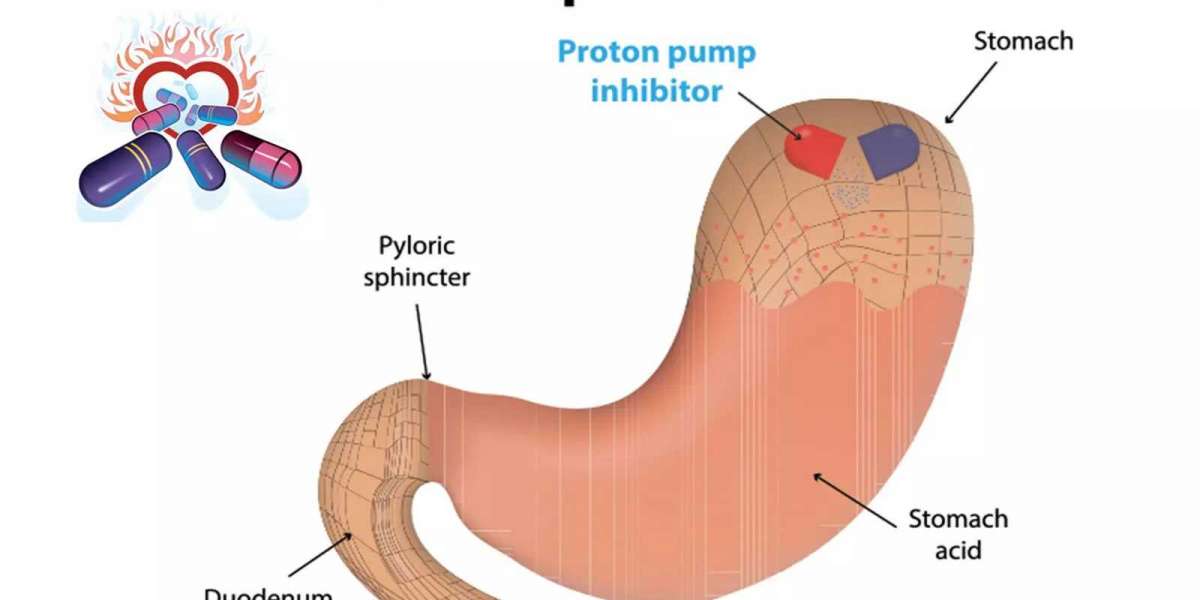 Heartburn Relief: Understanding Proton Pump Inhibitors (PPIs) in 2024
