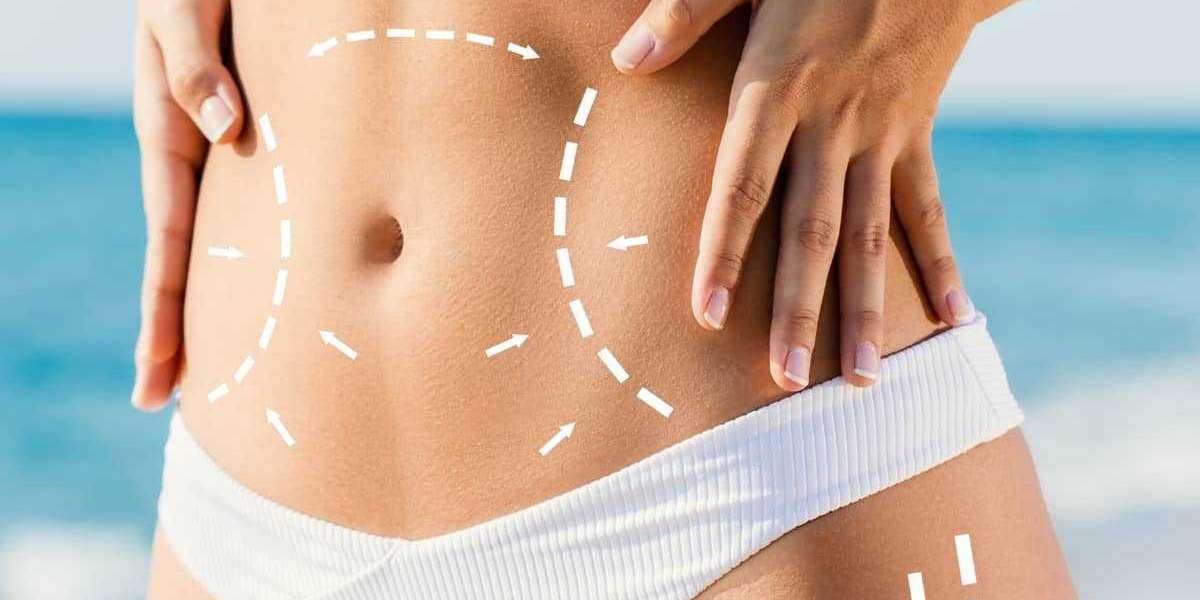 Body Contouring Surgery and Body Image: Insights from Best Doctors in Dubai